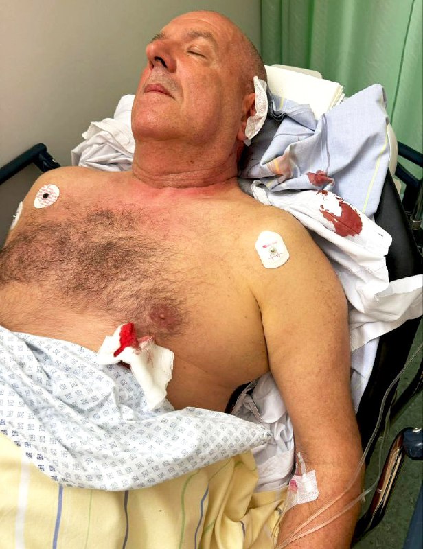 AfD-Koch: Das erste Foto nach dem Messer-Angriff Heinrich Koch, Weidels AfD-Mann...