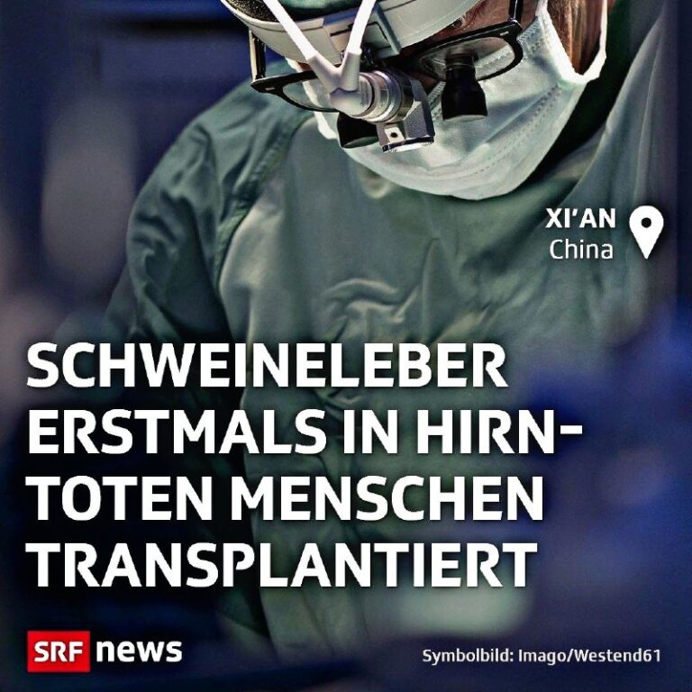  Schweineleber erstmals in hirntoten Menschen transplantiertChinesische Ärzte ha...